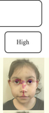Comparison of clinical geneticist and computer visual attention in assessing genetic conditions